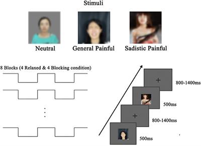 Embodiment and Humiliation Moderation of Neural Responses to Others' Suffering in Female Submissive BDSM Practitioners